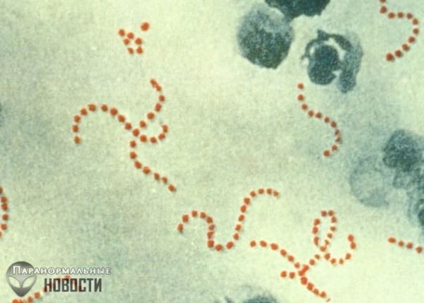 10 бактерий, которые могут заживо съесть человека